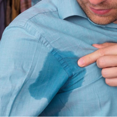 Excessive Sweating Treatment: Underarm