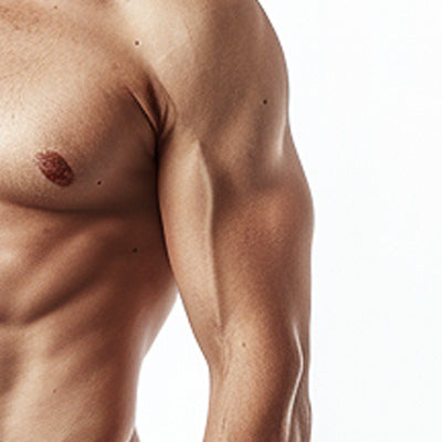 Men: Laser Hair Reduction: Upper Arms