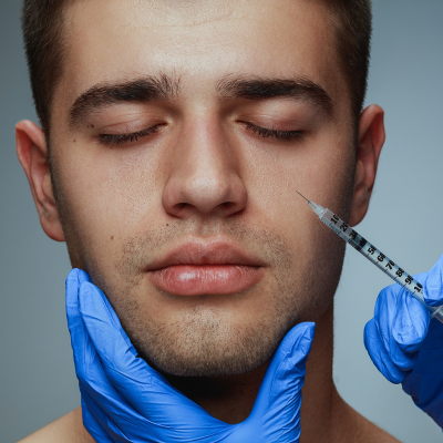 Men: Cheek Contouring: 1 Syringe Stylage