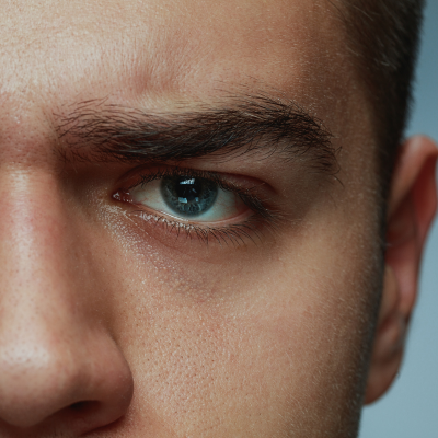 Men: Dark Circle Removal: Under-eye